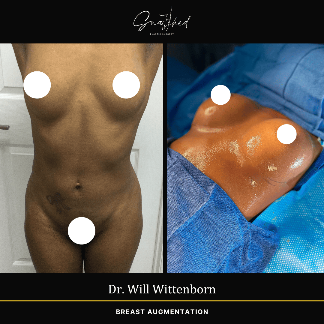 breastaug-02-wittenborn
