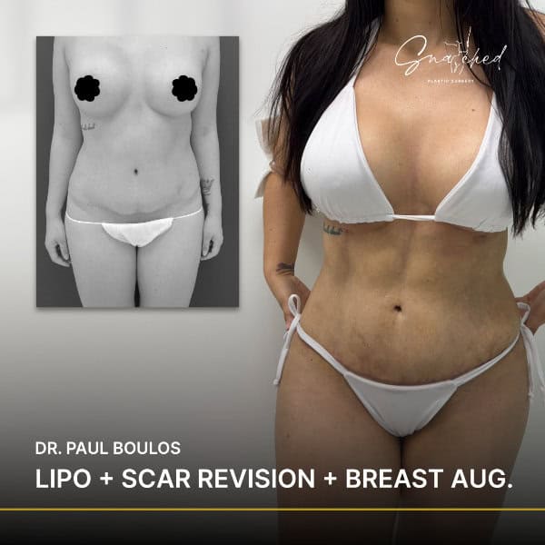 Before and after cosmetic surgery results.