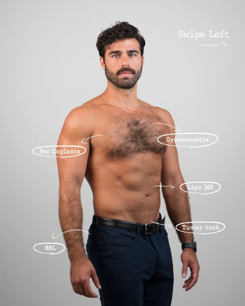 Man with cosmetic surgery annotations on body.