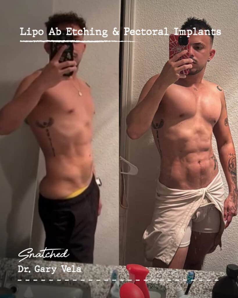 Before and after male body transformation photos.